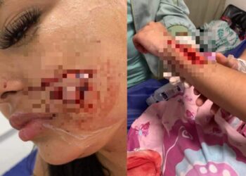 Con pico de botella, sujeto agredió a tres mujeres en Valledupar