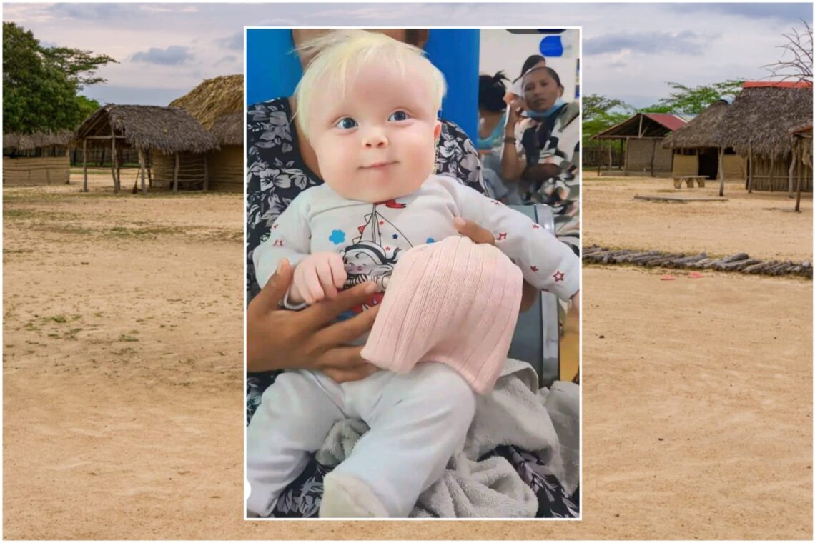 José David, el bebé wayuú albino que causa furor en las redes sociales